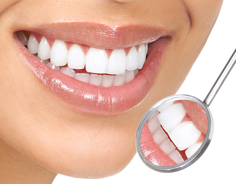 dental mirror reflecting mouth with really white teeth, Fountain Valley, CA teeth whitening